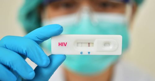 Understanding False Positive And False Negative HIV Test Results